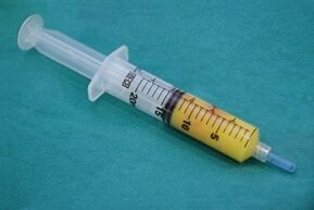 Jeringa con tejido adiposo para cirugía de agrandamiento del pene.