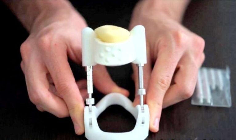 extensor para agrandar el pene